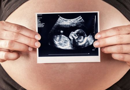 Plan Recadré D'une Femme Enceinte Avec Une Image D'échographie De Bébé