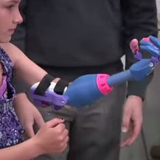 Grâce à la technologie, cette fillette handicapée peut enfin utiliser ses deux mains