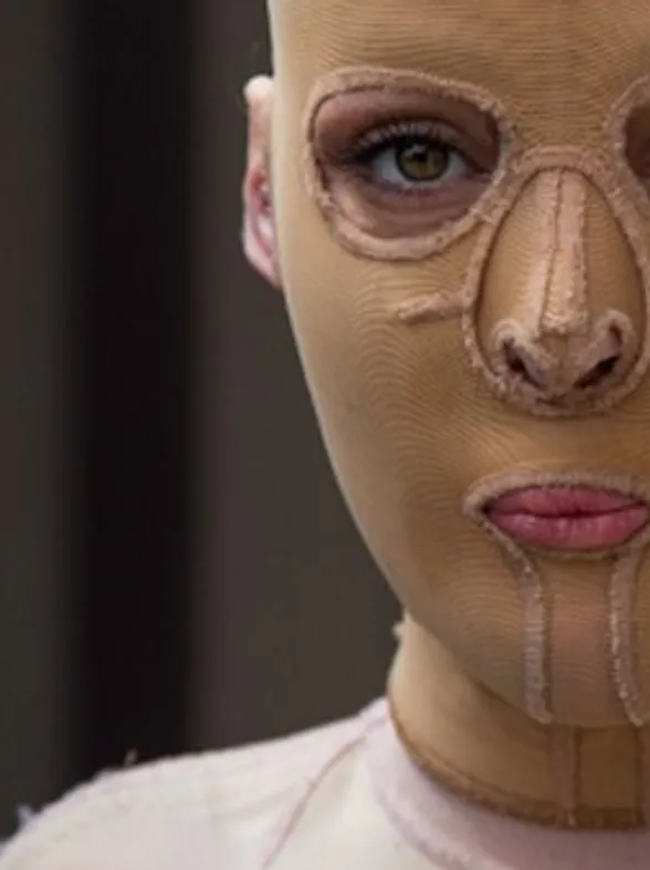 La increíble historia de Dana, la joven que descubre su rostro dos años después de que se lo quemasen