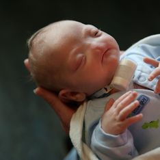 La historia de Eli, el bebé que nació sin nariz