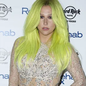 Kesha brilla, pero con el peor look de la semana