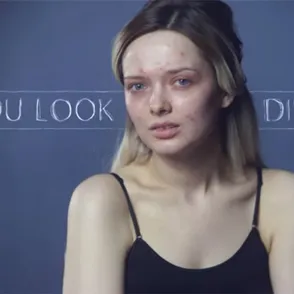 #YouLookDisgusting This Vlogger Has A Powerful Message About Beauty Ideals