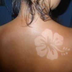 Le #SunBurnArt ou l’art de se créer des tatouages éphémères à partir de coups de soleil