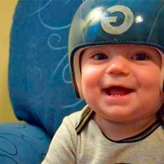 Artista pinta capacetes para bebês com síndrome da cabeça plana
