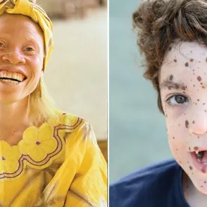 This Fashion Photographer is Celebrating Different Beauty Ideals in The Most Beautiful Way