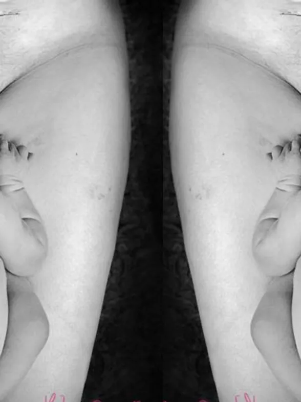 This Photographer Captured The Beauty Of A Mum’s Body Scars & All