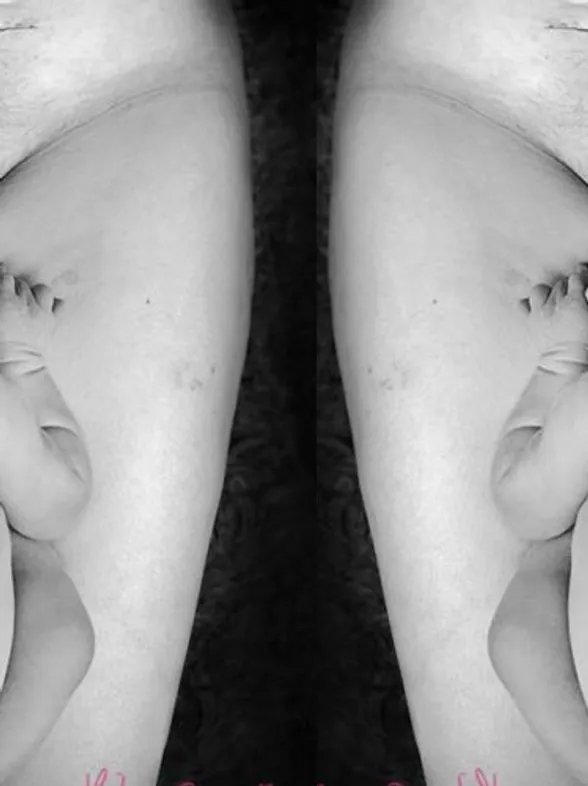 This Photographer Captured The Beauty Of A Mum’s Body Scars & All