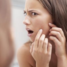 10 gestes qui stimulent la poussée d'acné
