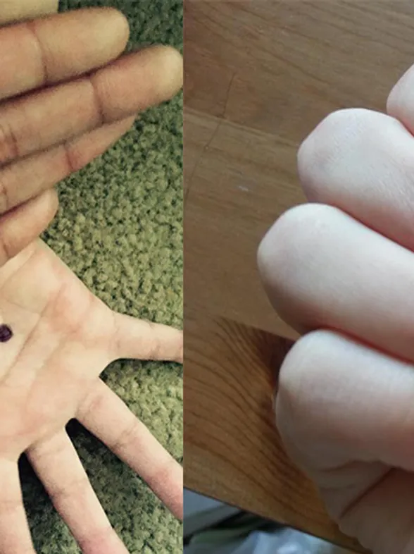 Black Dot Campaign Gives New Hope For Victims Of Domestic Abuse
