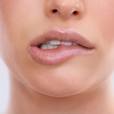 10 Momente, die leider jeder kennt, der unter Lippenherpes leidet