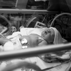 17 retratos del antes y el después de bebés prematuros que sobrevivieron a las adversidades