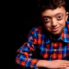 Las fotografías de niños con enfermedades raras que nos enseñan a mirar más allá de su condición