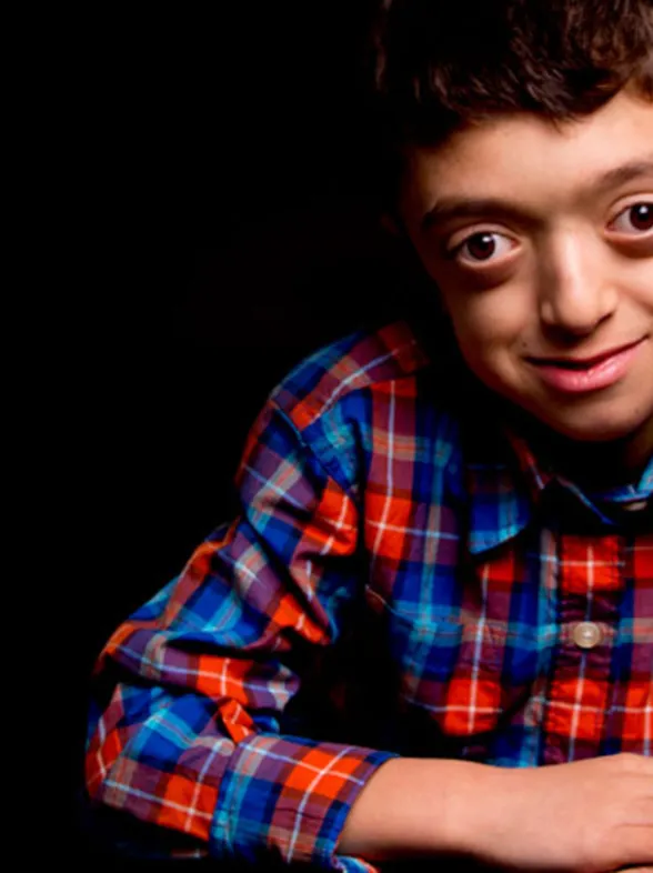 Las fotografías de niños con enfermedades raras que nos enseñan a mirar más allá de su condición