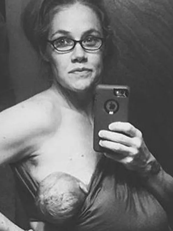 El selfie más auténtico: "Así es como queda tu cuerpo 24 horas después del parto"