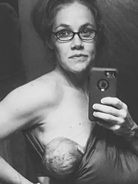 El selfie más auténtico: "Así es como queda tu cuerpo 24 horas después del parto"