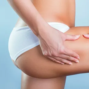 Yesoterapia: una nueva forma de combatir la celulitis