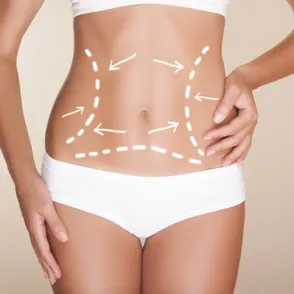 La importancia del postoperatorio tras una liposucción