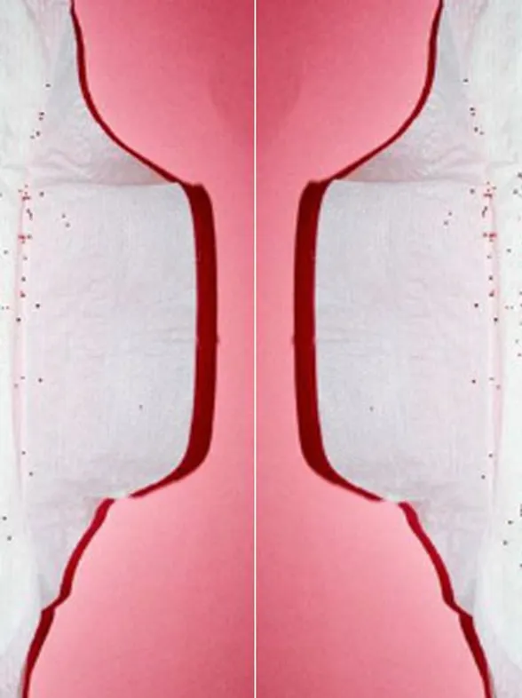 17 Things That Are All Too Real For Girls With Chronic Period Pain