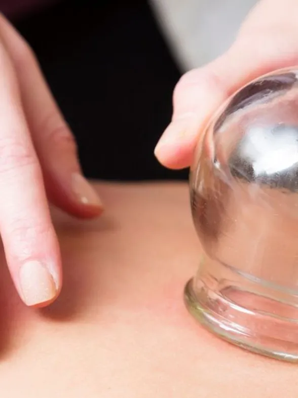 El cupping, uno de los tratamientos más requeridos por los deportistas