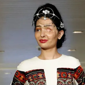 Esta modelo india, víctima de un ataque con ácido, triunfa en la pasarela de Nueva York