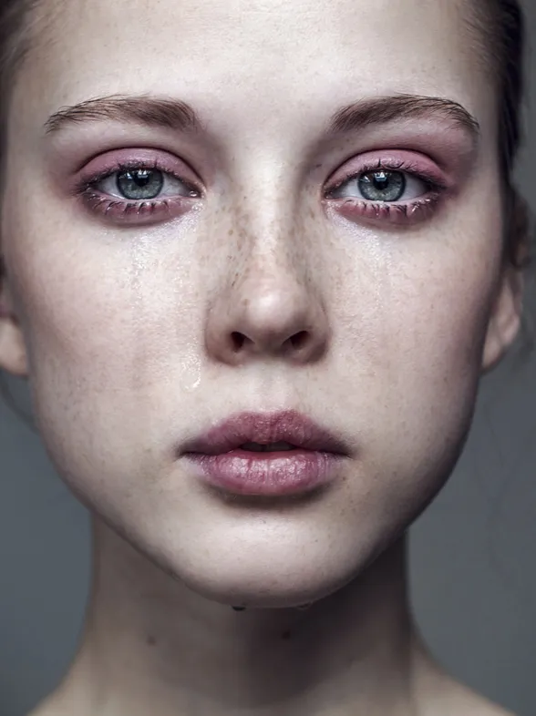 El lado emocional de la dermatología. ¿Cómo nos afectan los problemas de la piel?