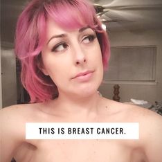 DAS ist Brustkrebs - Diese Mutter hat eine Botschaft für alle Menschen, die sie anstarren