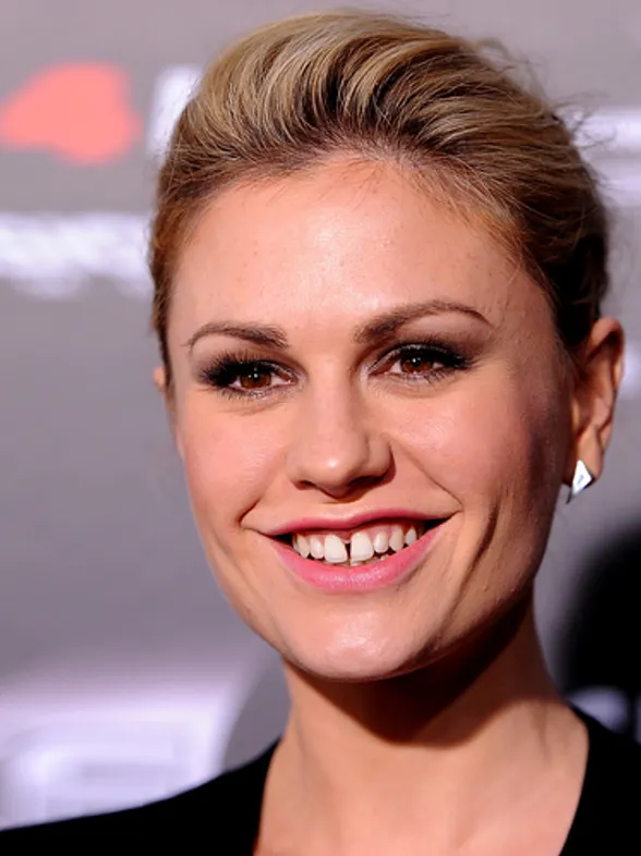 Famosos con diastema, ¿quién dijo que las sonrisas imperfectas no eran guays?