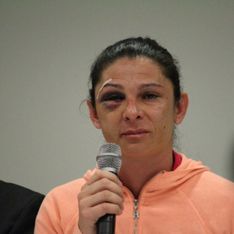 Cette sportive mexicaine a été battue et insultée simplement parce qu'elle est une femme (Photos et Vidéo)