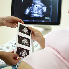 Crescita del feto: lo sviluppo del bambino mese per mese