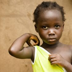 Planchado de senos, la tortura que aún sufren algunas niñas en Camerún
