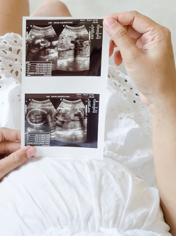 Geburtstermin-Rechner: SSW berechnen und auf Babys Ankunft freuen