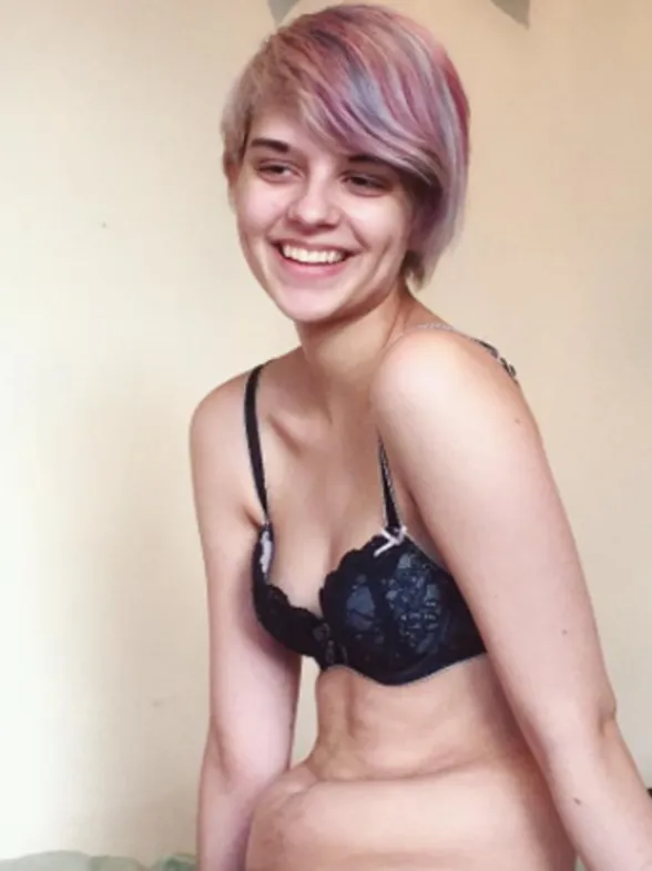 La batalla contra la anorexia de una joven que está inspirando Instagram