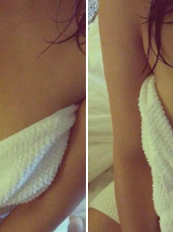 This Woman's Smart Phone Burned Her Boob And It Should Be A Lesson To Us All