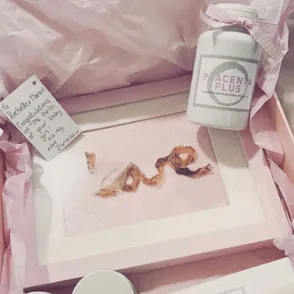 Rochelle Humes Framed Her Newborn Baby's Umbilical Cord And People Are Equally Disgusted And Amazed