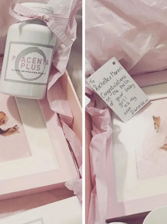 Rochelle Humes Framed Her Newborn Baby's Umbilical Cord And People Are Equally Disgusted And Amazed