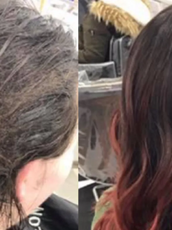 This Before & After Photo Of A Woman Suffering From Depression Has Gone Viral For All The Right Reasons