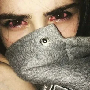 This Woman Was Blinded By Her Contact Lenses