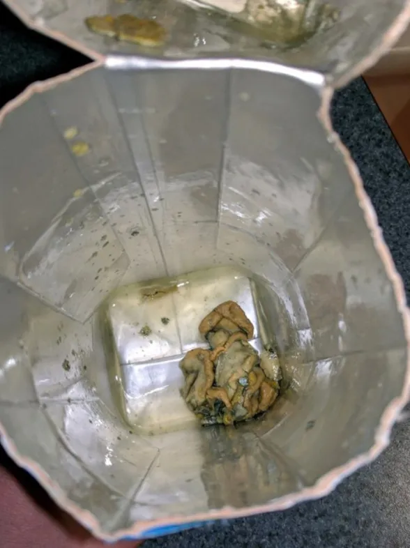 This Woman Found A "Squid Like" Object In Her Fancy Coconut Water