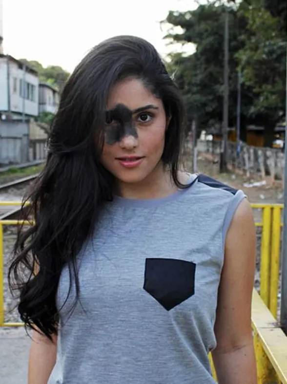 ¿Quién dijo que las manchas no eran bellas? Conoce la increíble historia de Mariana Mendes
