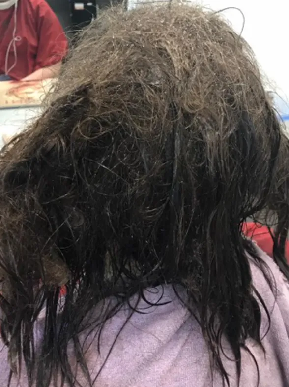 Hairdresser Refused To Shave Depressed Teen's Hair For The Best Reason