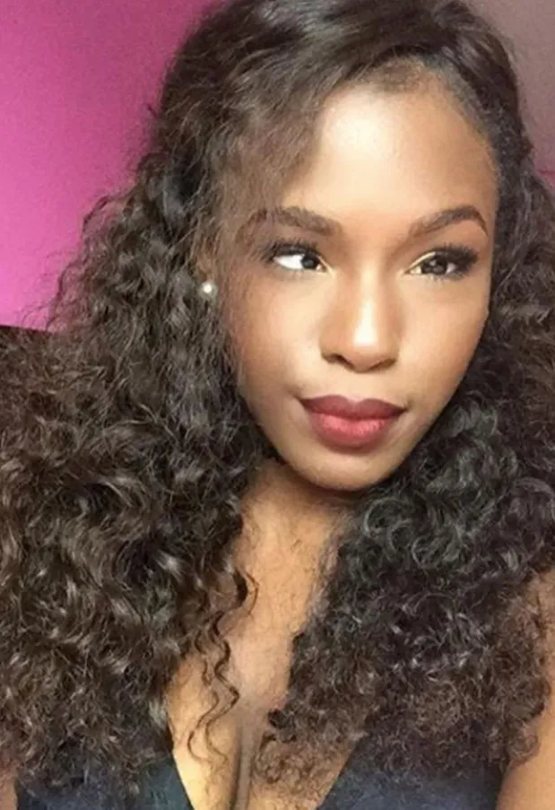 This Cross-Eyed Blogger Has An Important And Inspiring Message For Us All