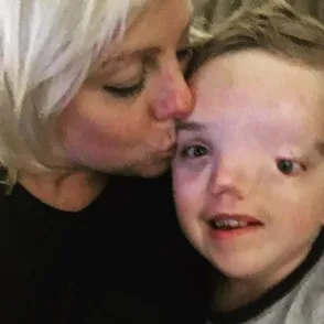 Instagram censura una foto de un niño enfermo y su madre responde así