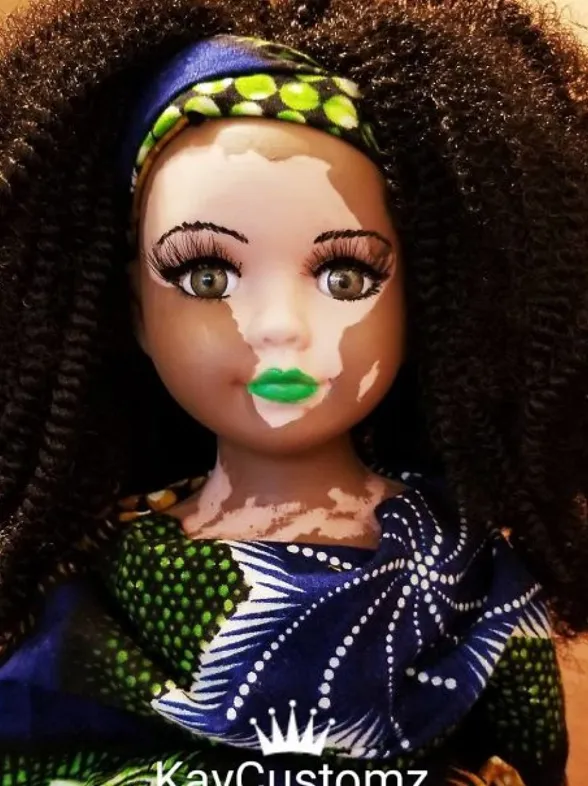 Una artista crea estas muñecas con vitíligo para ayudar a los niños con esta enfermedad