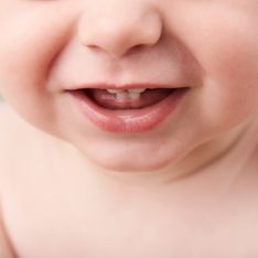 I primi dentini del bambino: sintomi, disturbi e tutto quello che c'è da sapere