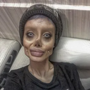 Esta chica se somete a 50 operaciones para parecerse a Angelina Jolie