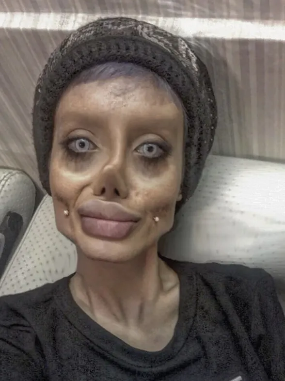 Esta chica se somete a 50 operaciones para parecerse a Angelina Jolie