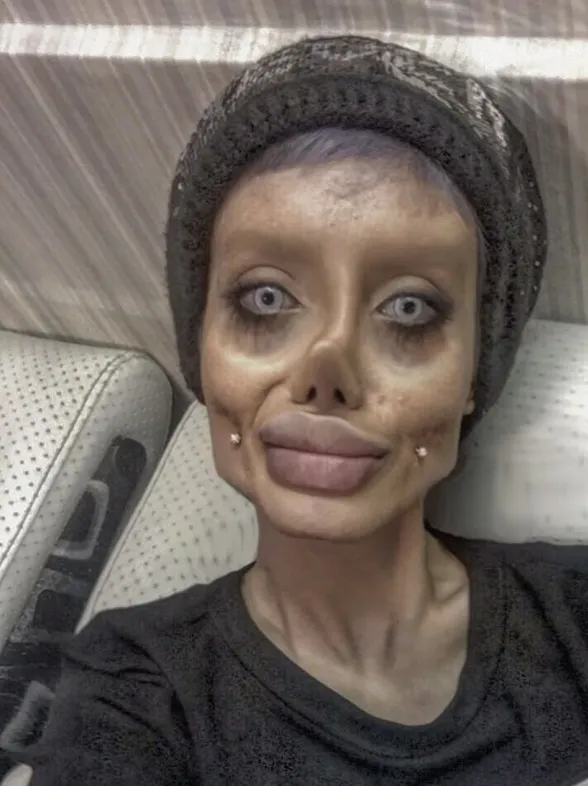 Esta chica se somete a 50 operaciones para parecerse a Angelina Jolie