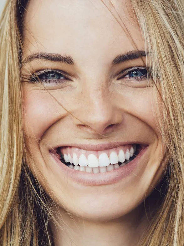 Estética de encías: los mejores tratamientos para presumir de sonrisa