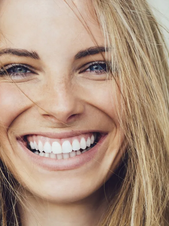 Estética de encías: los mejores tratamientos para presumir de sonrisa