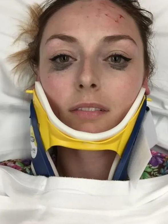 Una chica descubre el delineador perfecto tras sufrir un accidente